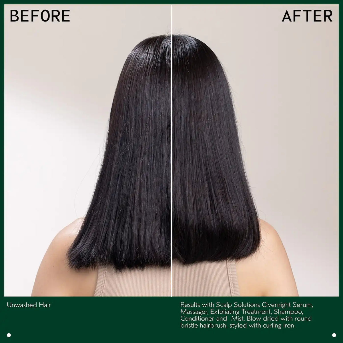 scalp solutions stimulating scalp massager